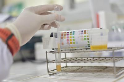 What does a standard drug test screen for? | Health Street blog article