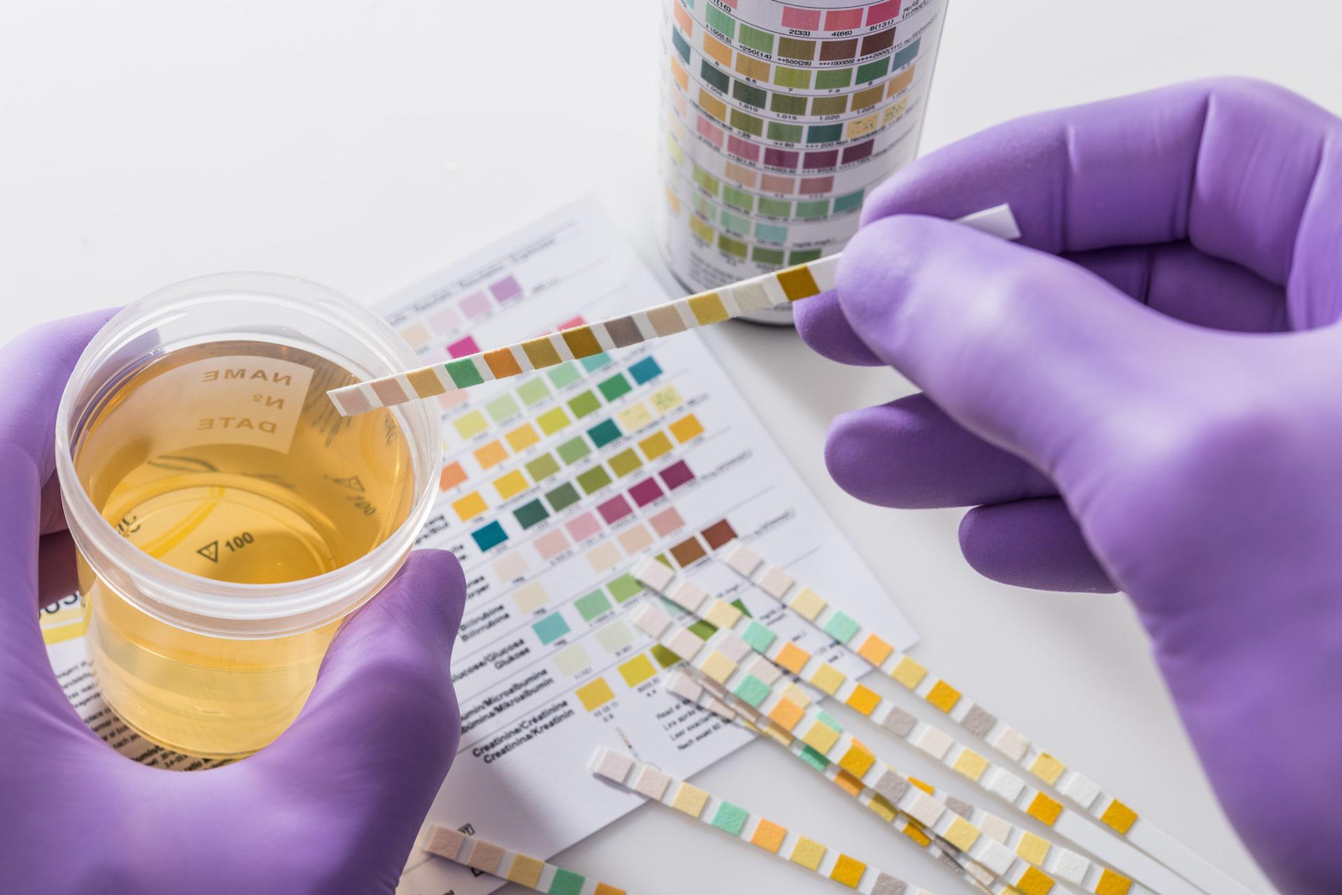 Does Weed Show Up In Urine Tests? - featured