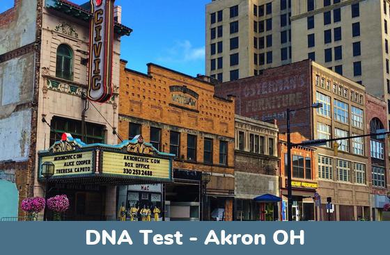 Akron OH DNA Testing Locations