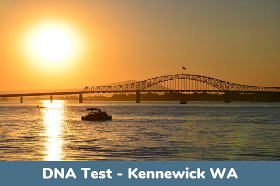 Kennewick WA DNA Testing Locations
