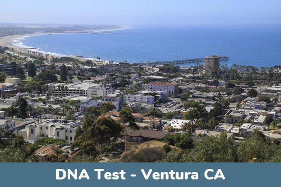 Ventura CA DNA Testing Locations
