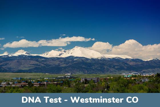 Westminster CO DNA Testing Locations