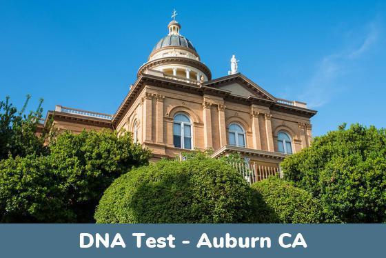 Auburn CA DNA Testing Locations