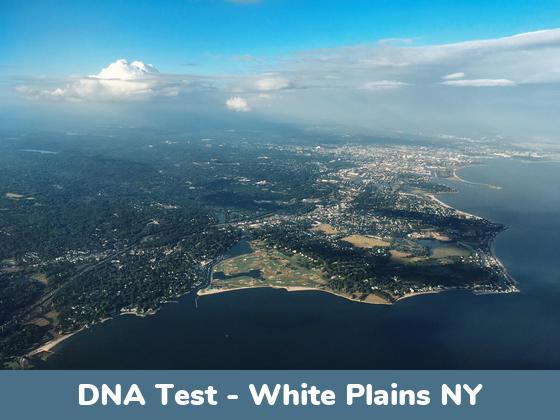 White Plains NY DNA Testing Locations
