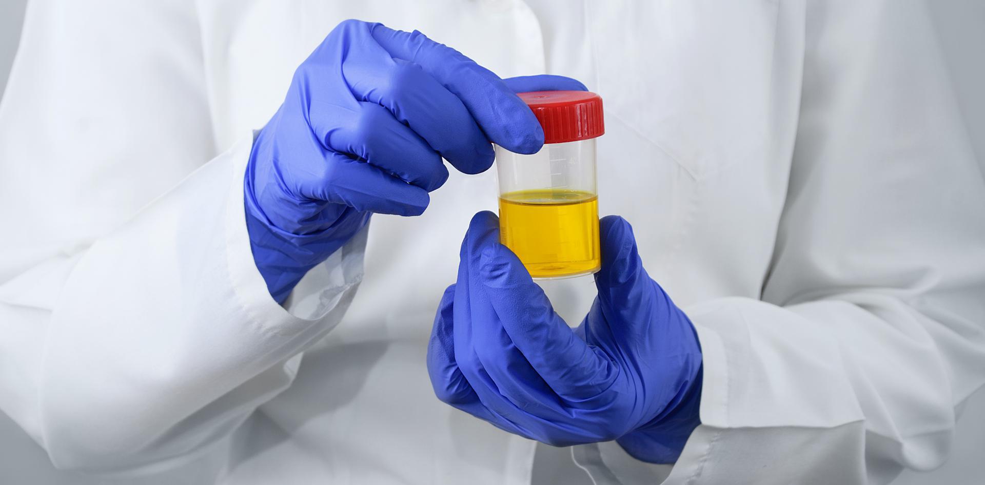 6 Panel Urine Drug Test | Health Street