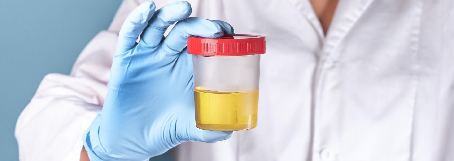7 Panel Urine Drug Tests - info-hero