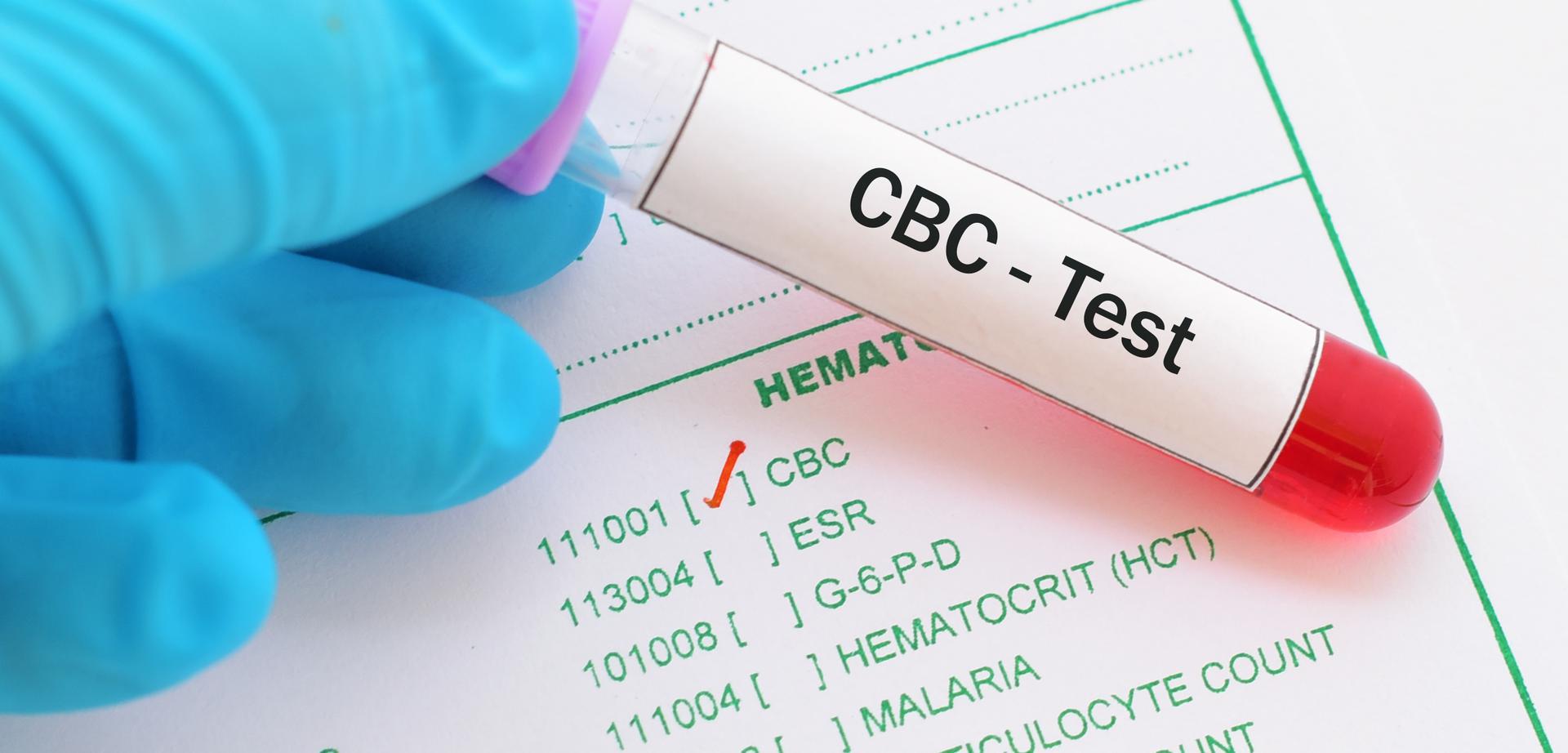 CBC Blood Test Blood Count) Health Street