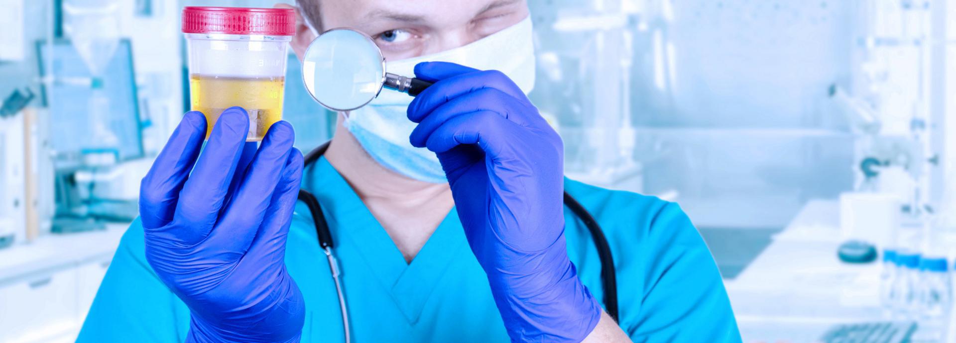 EtG Urine Alcohol Test EtG Urine Alcohol Test - info-hero