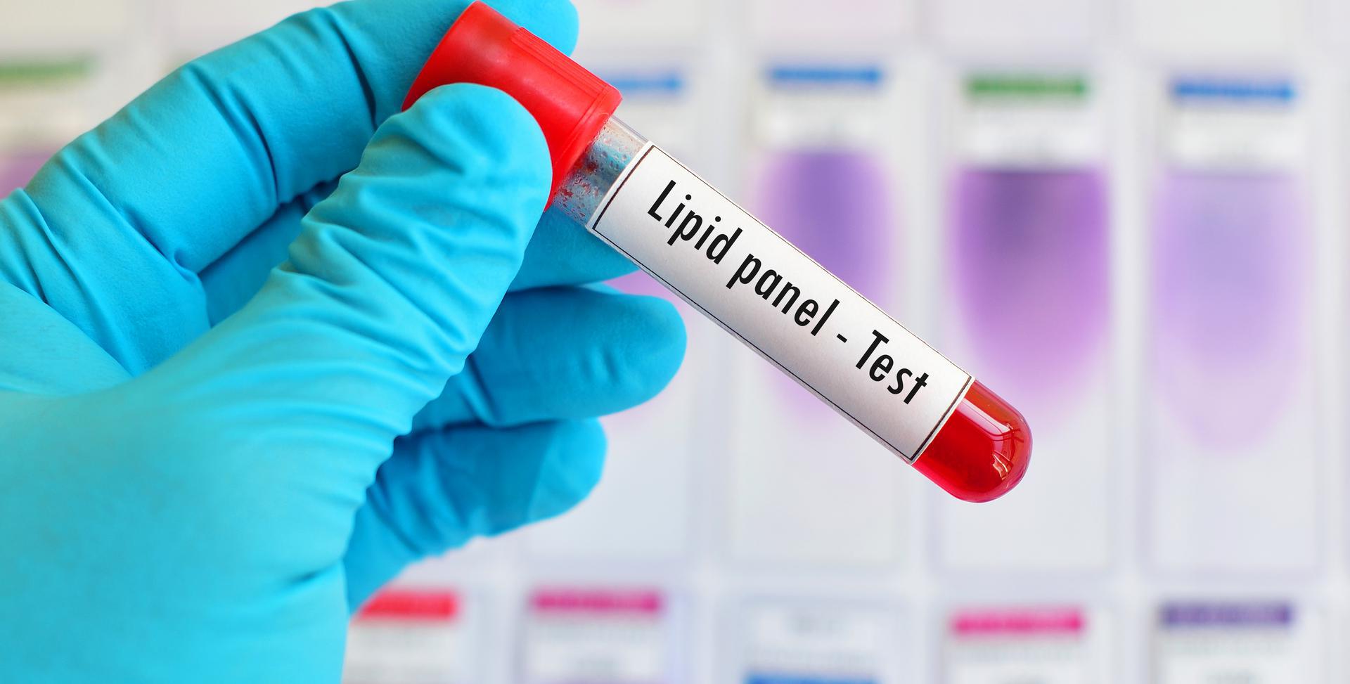 How Long To Fast For A Lipid Panel Blood Test