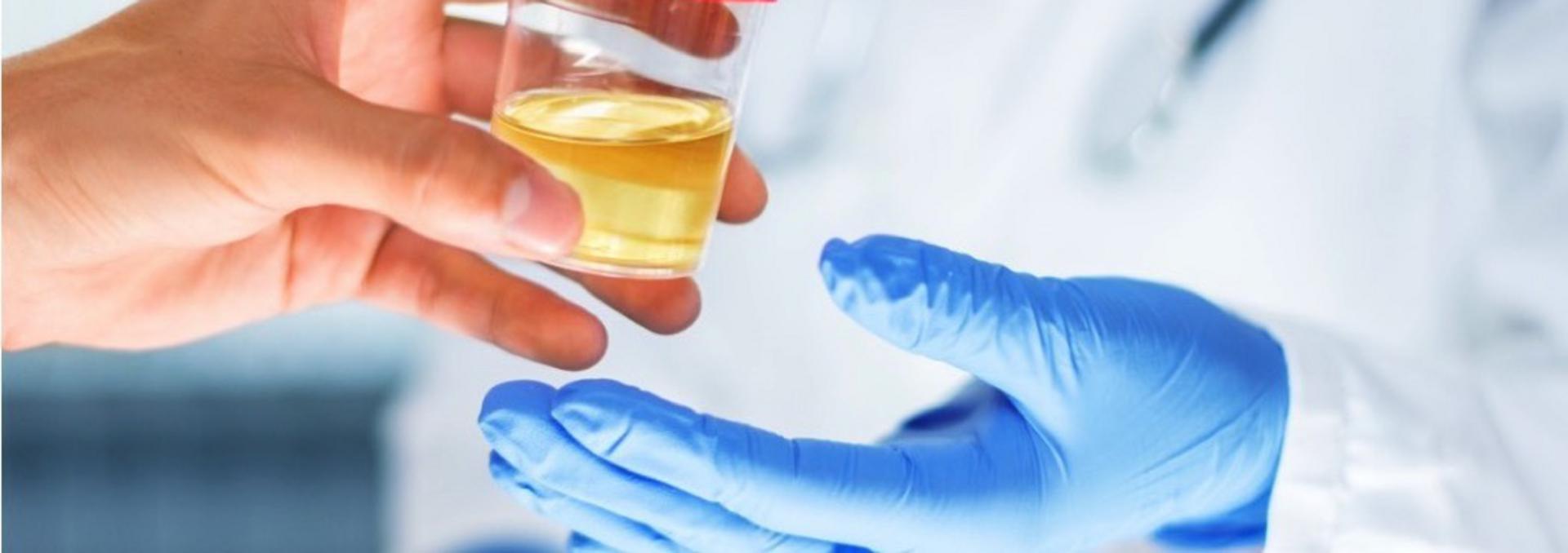 Urine Drug Testing - info-hero